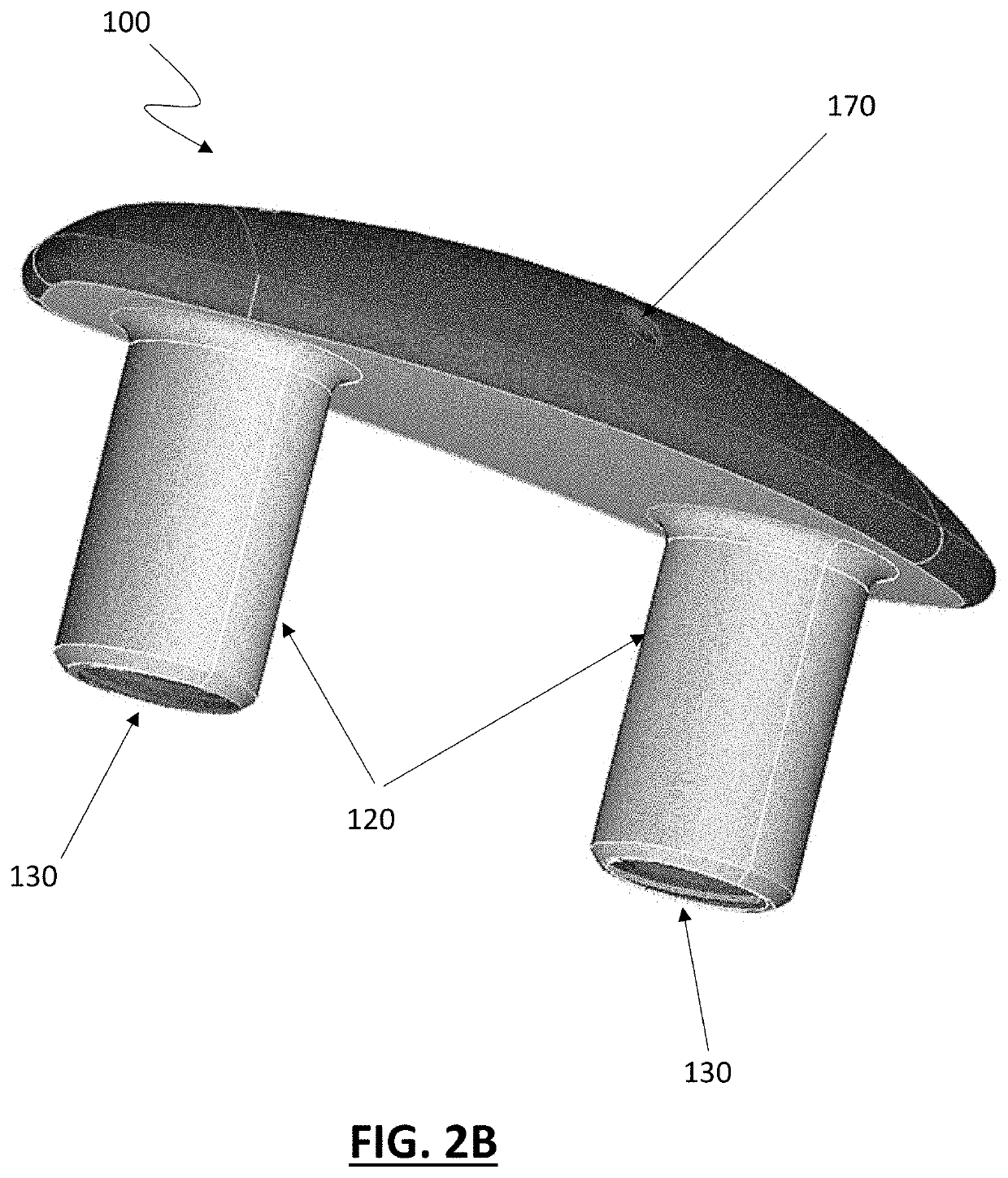 Partial glenoid arthroplasty