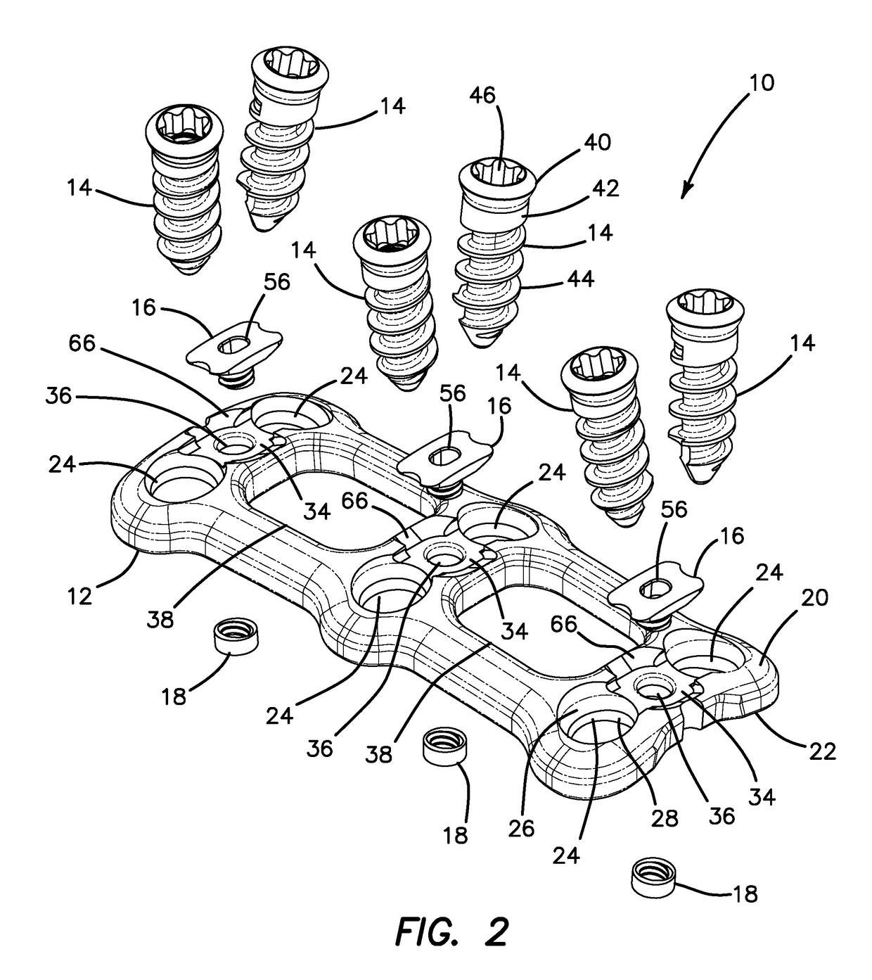 Anterior cervical plate