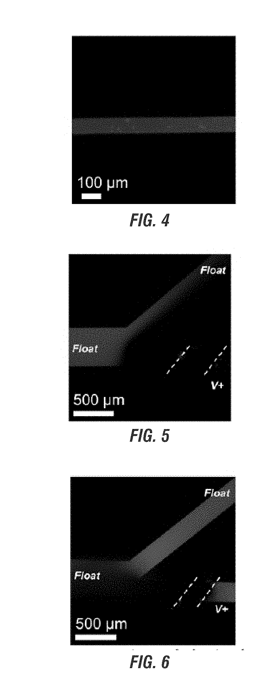 Electrokinetic route to a wearable device for kidney disease management