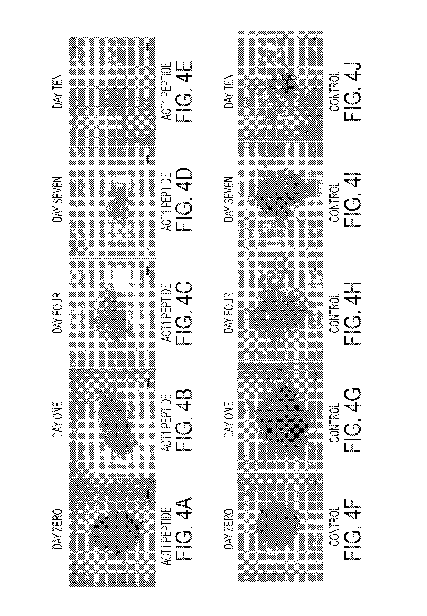 Compositions and methods for wound healing and tissue repair