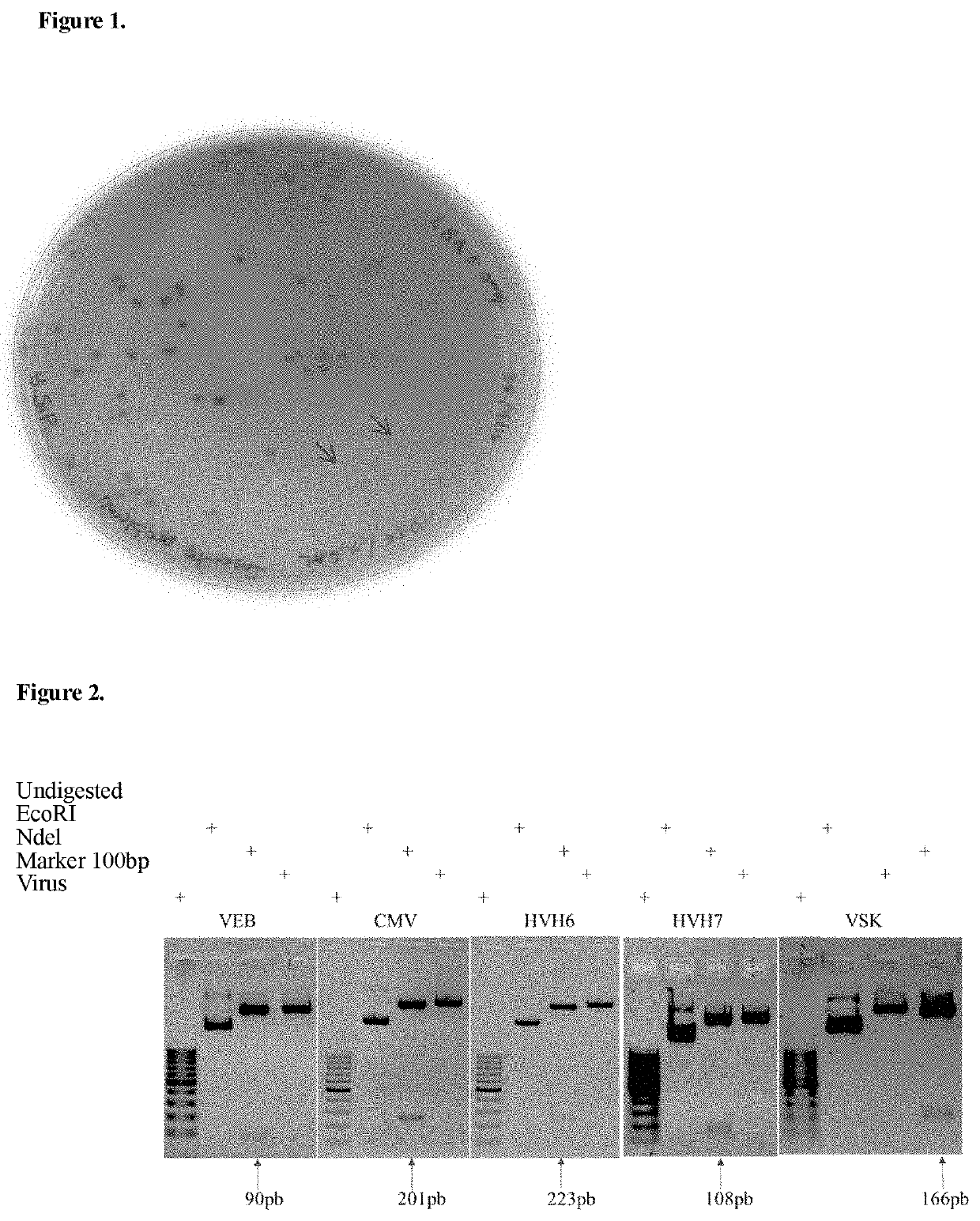 Method For The Simultaneous Detection And Quantification Of Epstein-Barr Virus, Cytomegalovirus, Human Herpesvirus 6, Human Herpesvirus 7 and Kaposi's Sarcoma Virus Using A Multiplex, Real-Time Polymerase Chain Reaction