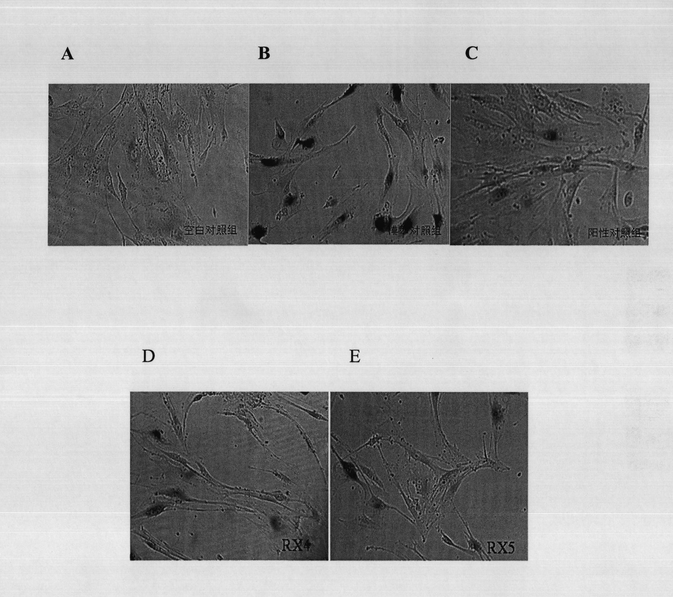 Pilos antler extraction method and pilos antler extract obtained by same