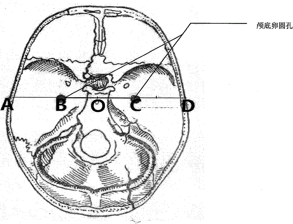Puncture instrument for positioning center of oval foramen of cranial base