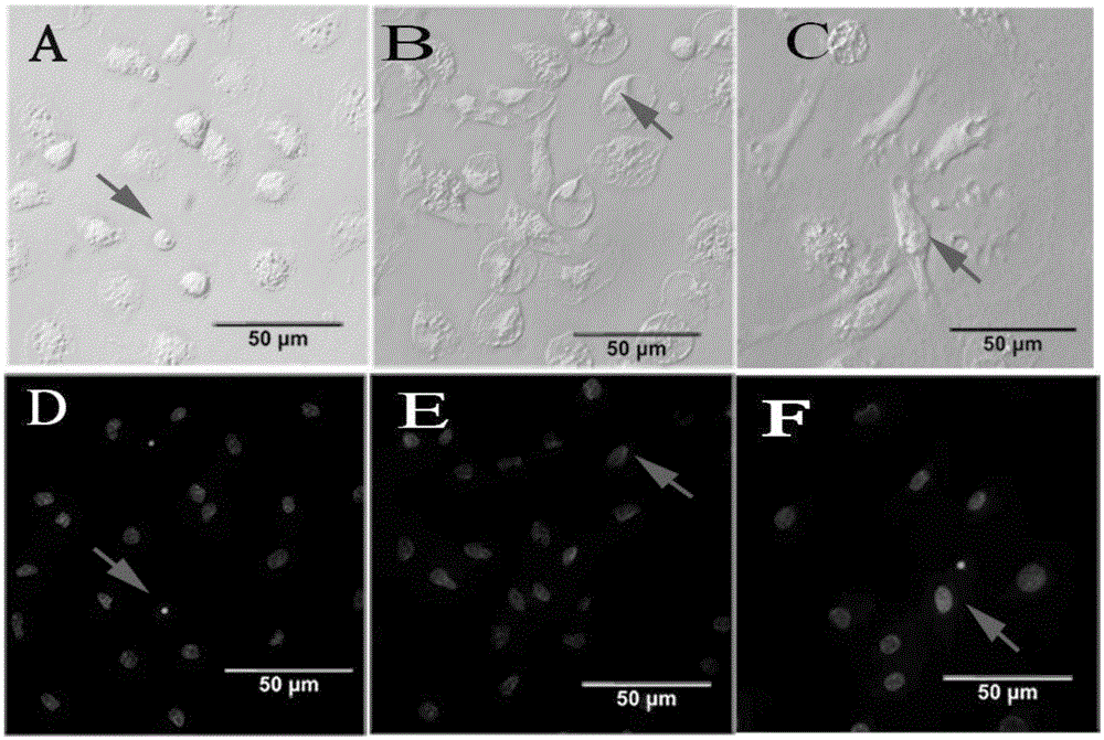 Separating and culturing methods and induction medium of chicken functional macrophage