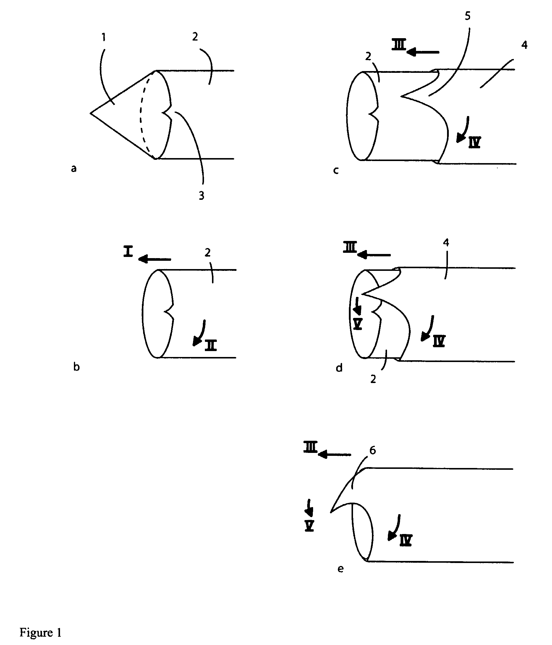 Method and device to obtain percutaneous tissue samples