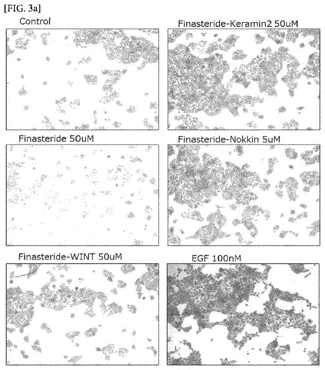 Conjugate of finasteride with peptide