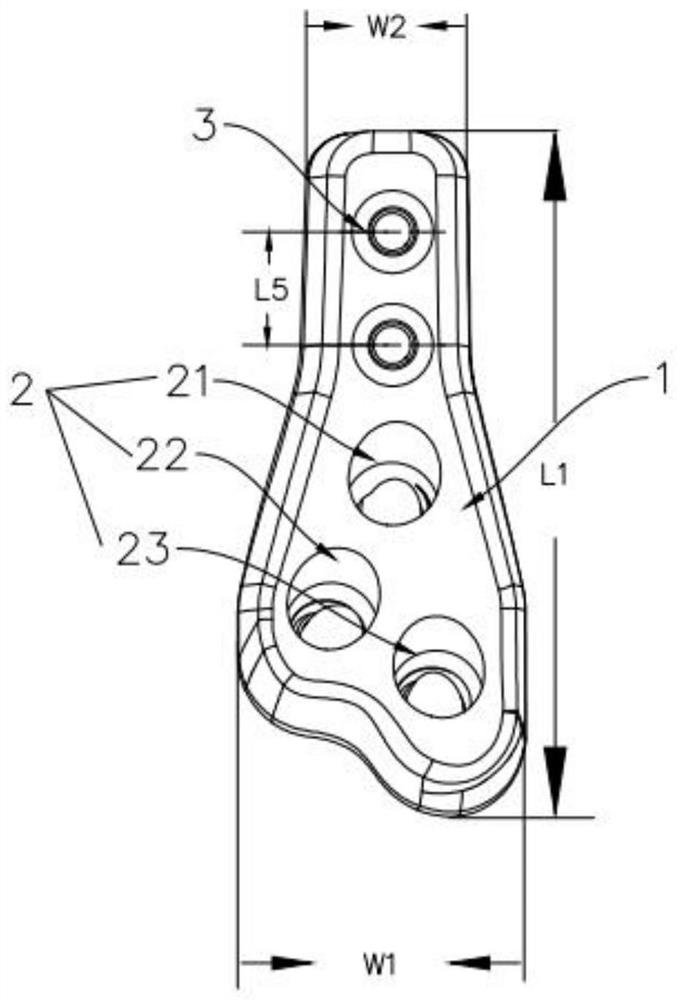 Dynamic pressurizing device for bone trauma repair