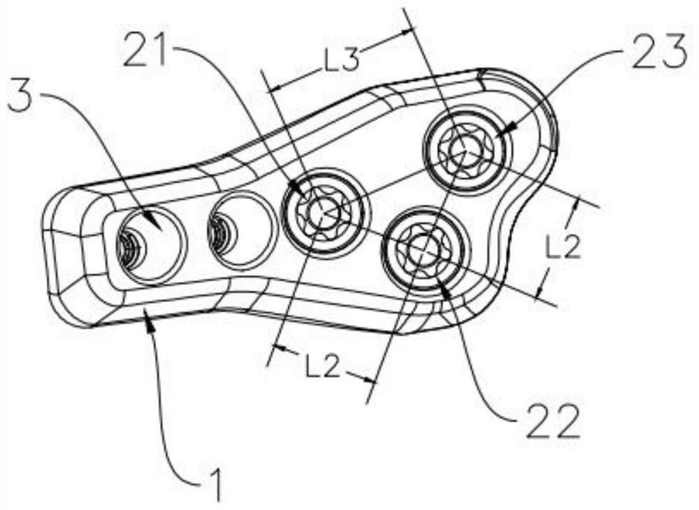 Dynamic pressurizing device for bone trauma repair