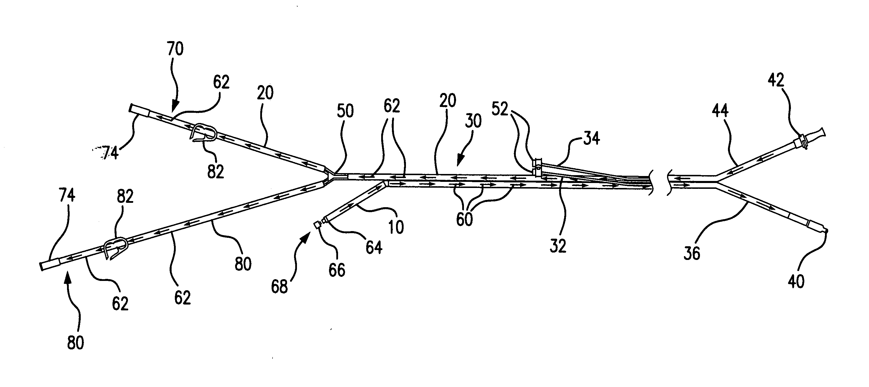 Method and system providing more accurate fluid temperature monitoring with selectable fluid input and output arragements for body cavity treatments