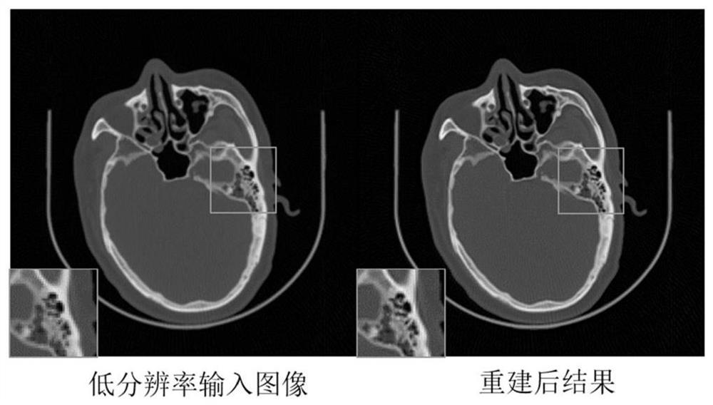 Dual-energy CT super-resolution image reconstruction method and system based on sparse representation