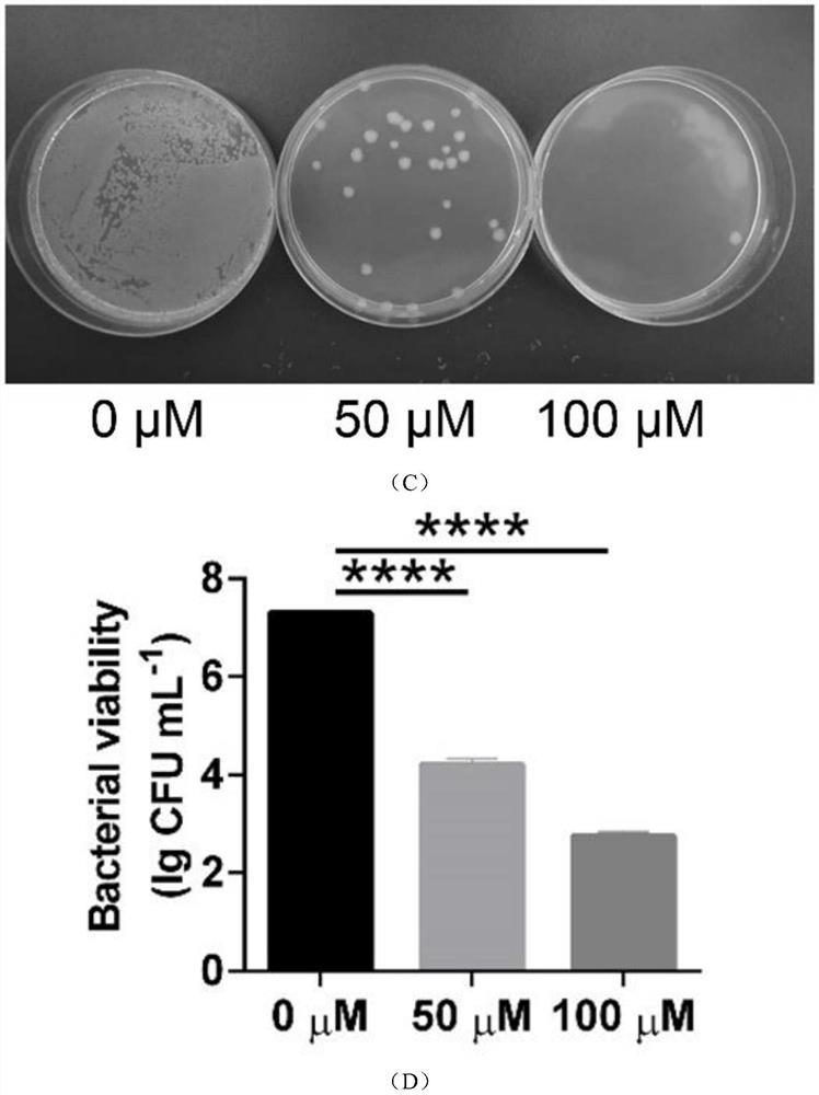 Application of nanogold in preparation of medicine for treating shigella infectious enteritis and medicine preparation of nanogold