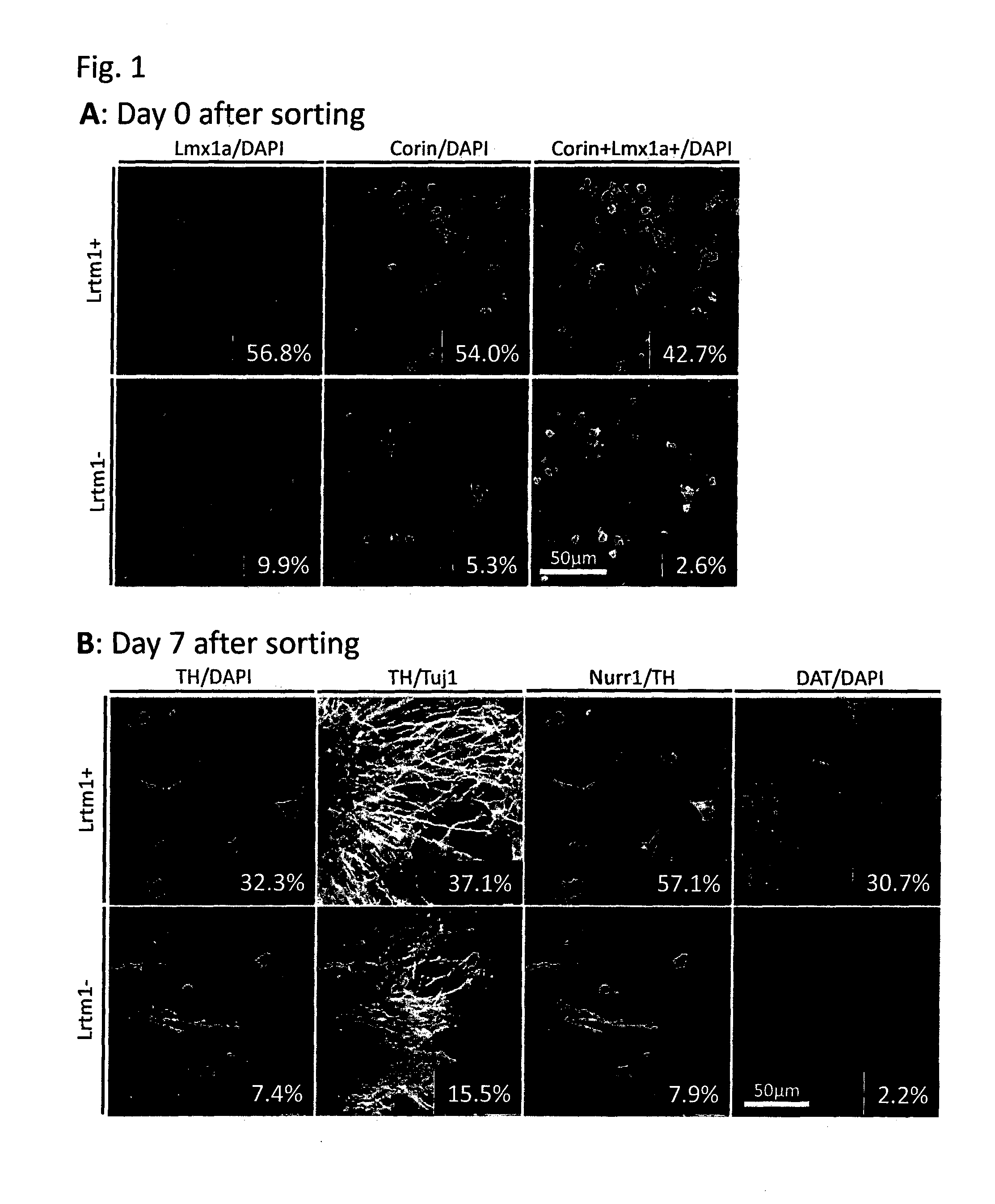 Novel markers for dopaminergic neuron progenitor cells