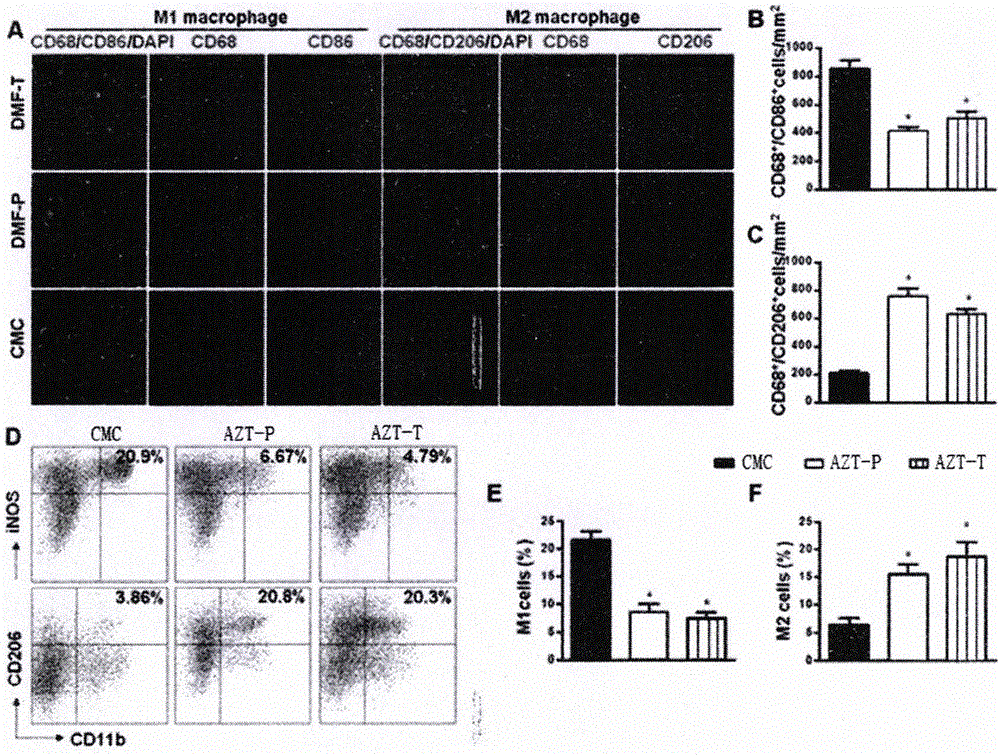 Application of zidovudine used for preparation of medicine for treating autoimmune neuritis