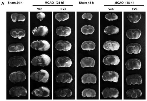 Application of mesenchymal stem cell derived extracellular vesicles to cerebral ischemia-reperfusion injury