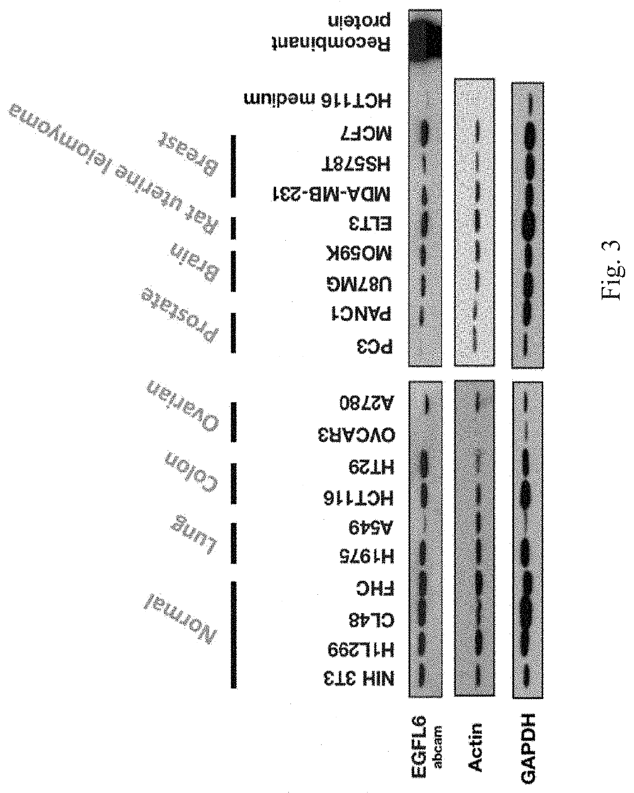 Anti-egf like domain multiple 6 (EGFL6) antibodies and their applications in cancer diagnosis and treatment