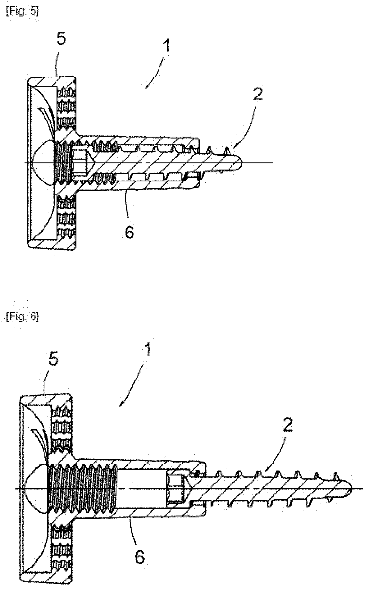 Assembly Formed By A Bone Anchoring Base Belonging to a Prosthetic Joint and by at Least One Screw Fastening This Base to a Bone