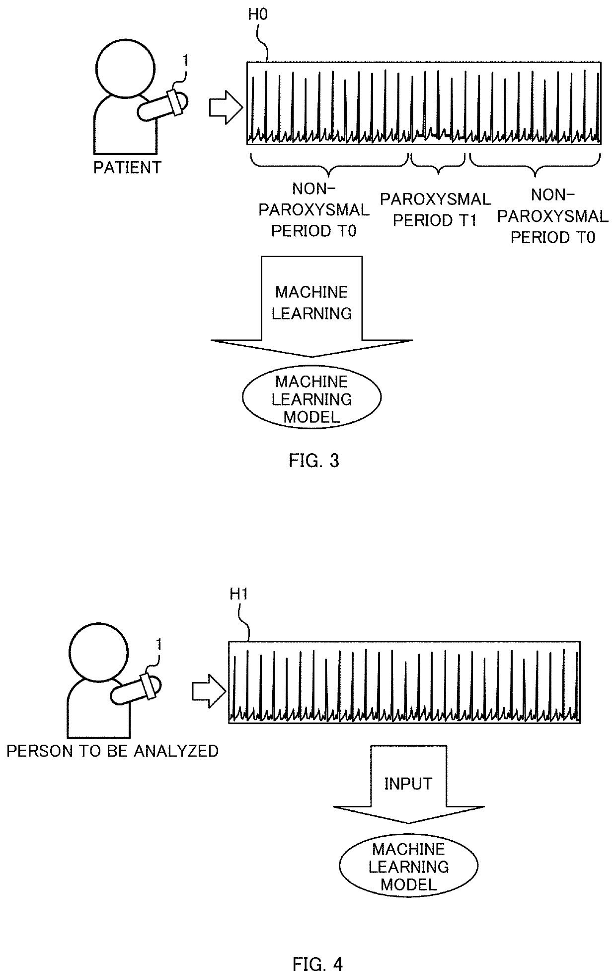 Electrocardiogram analysis apparatus, electrocardiogram analyzing method, and non-transitory computer-readable storage medium