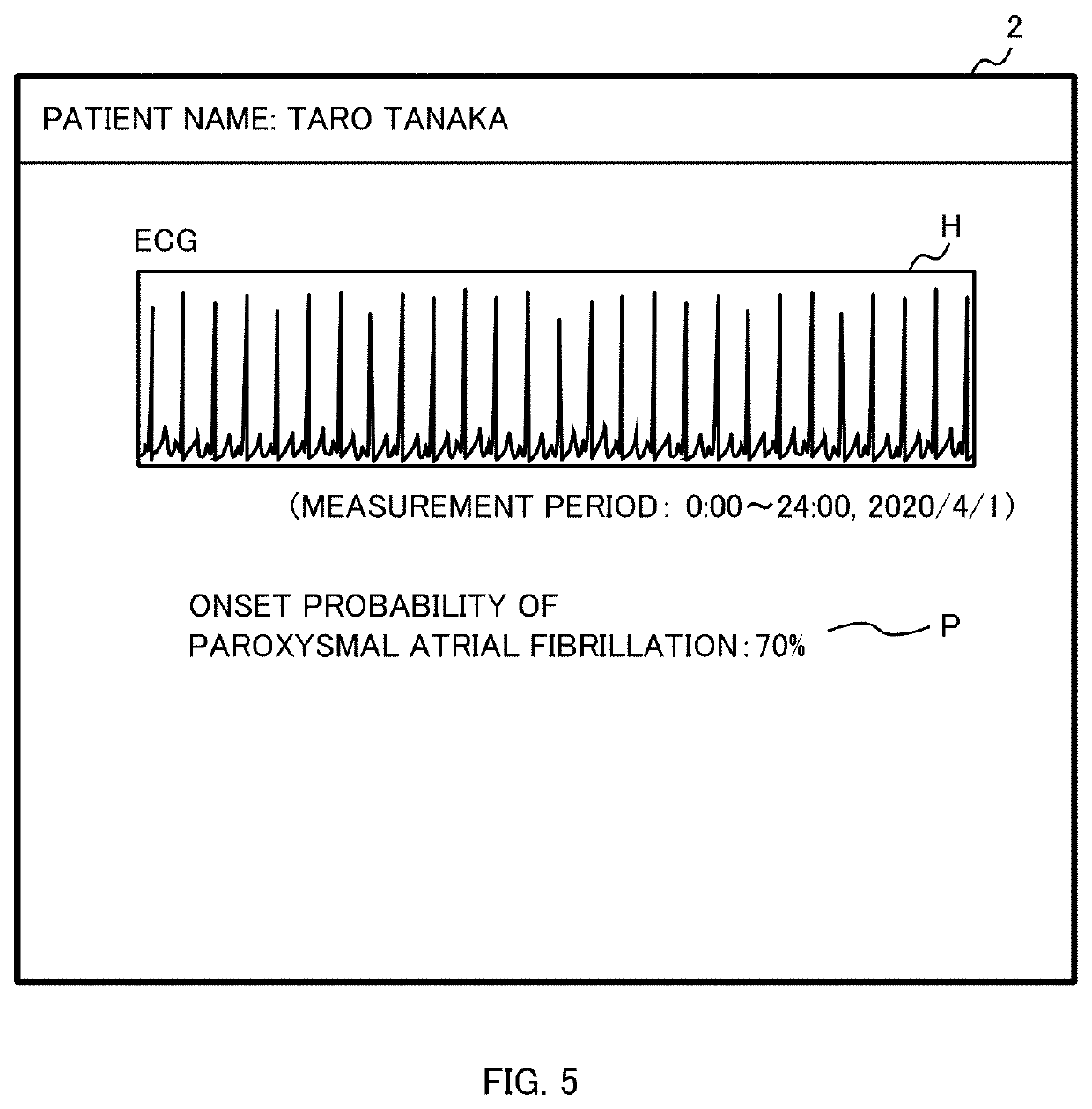 Electrocardiogram analysis apparatus, electrocardiogram analyzing method, and non-transitory computer-readable storage medium