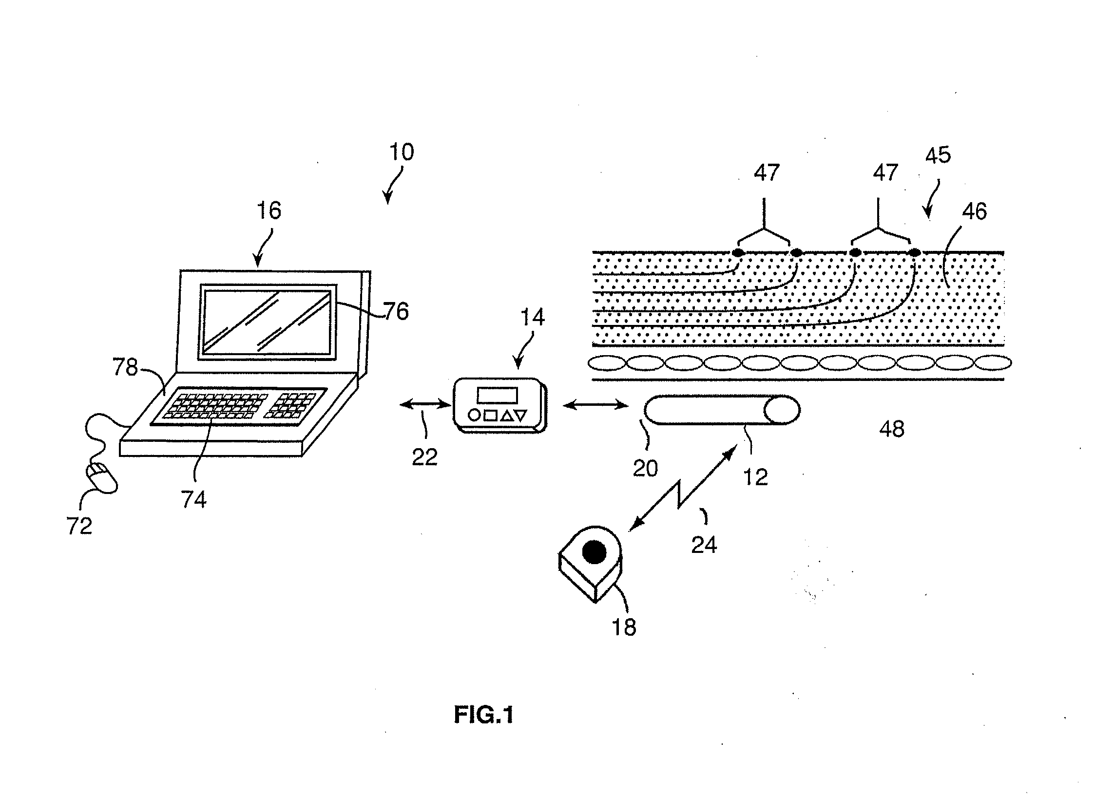 Method for selectively performing local and radial peripheral stimulation