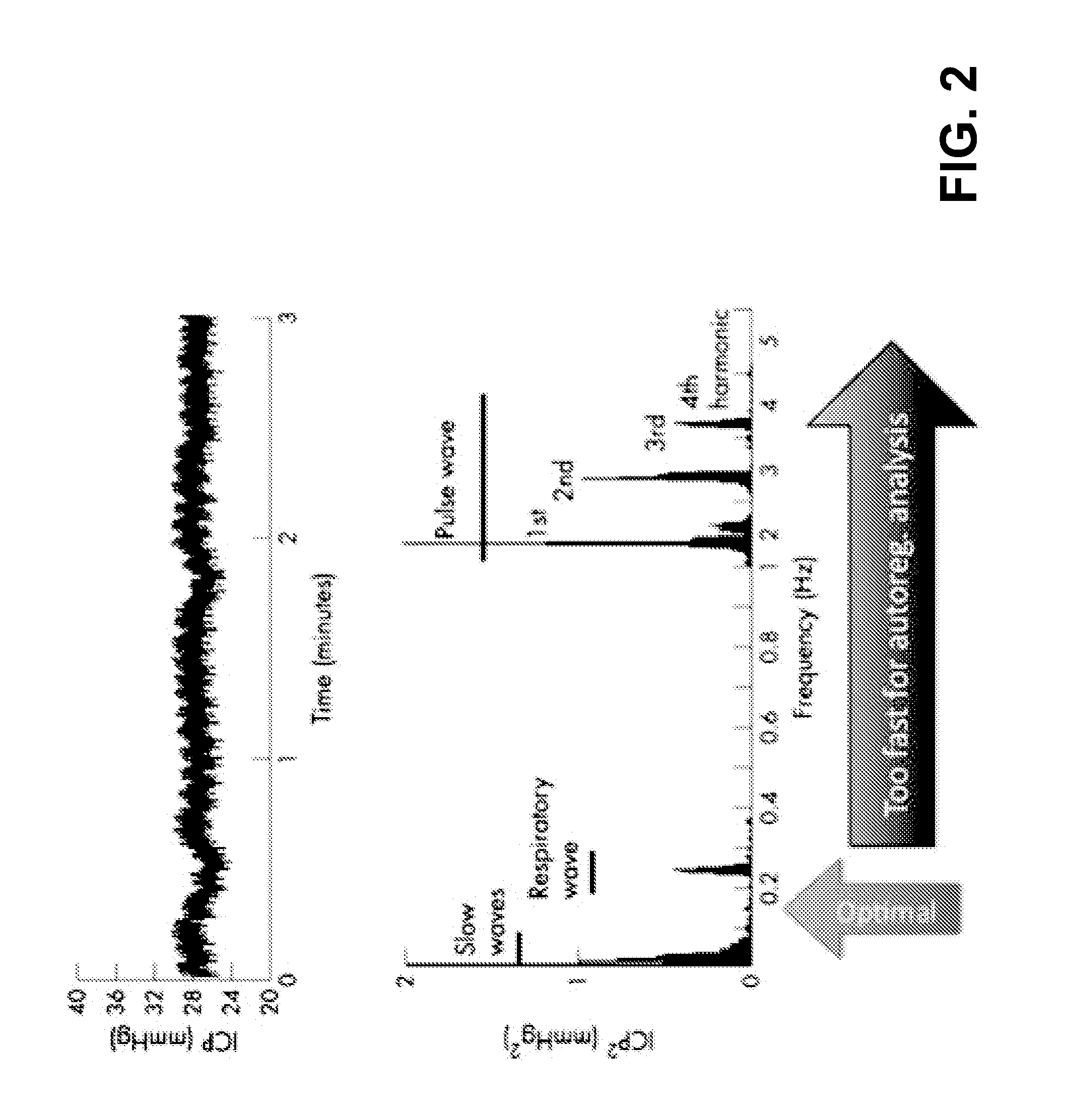 Autoregulation monitoring