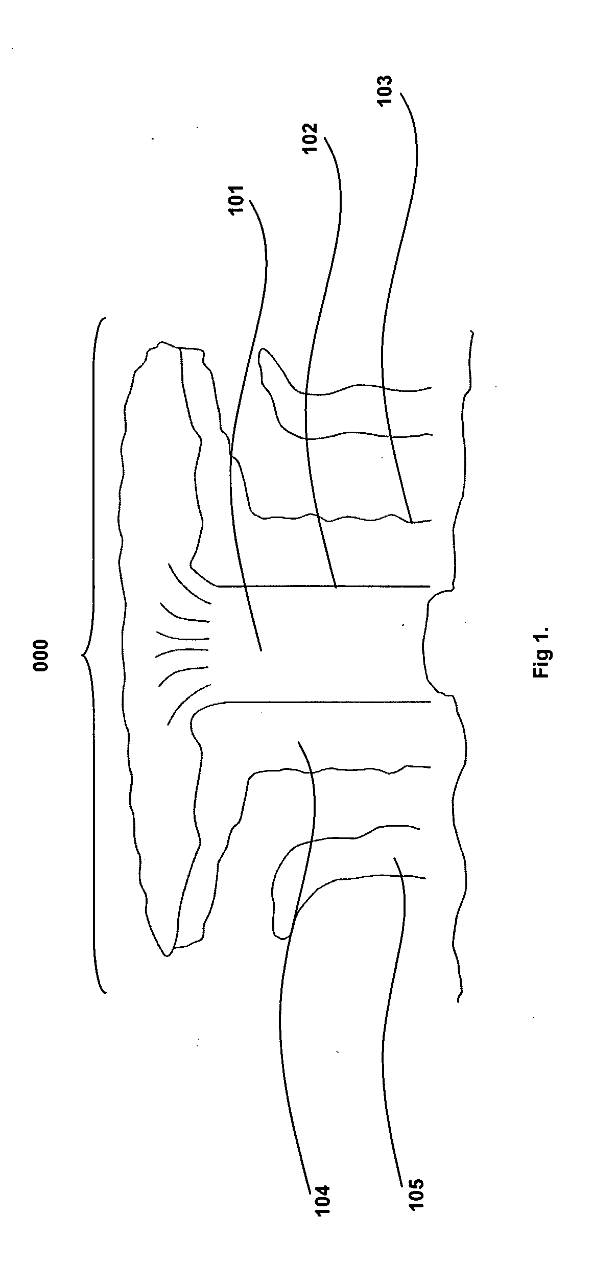 Method and system for accelerating dissipation of a landfalling tropical cyclone