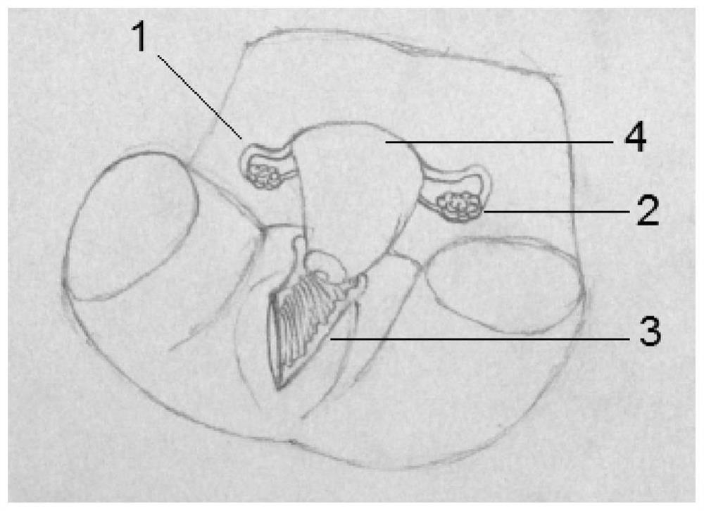 A kind of simulated egg retrieval model and its use method and application