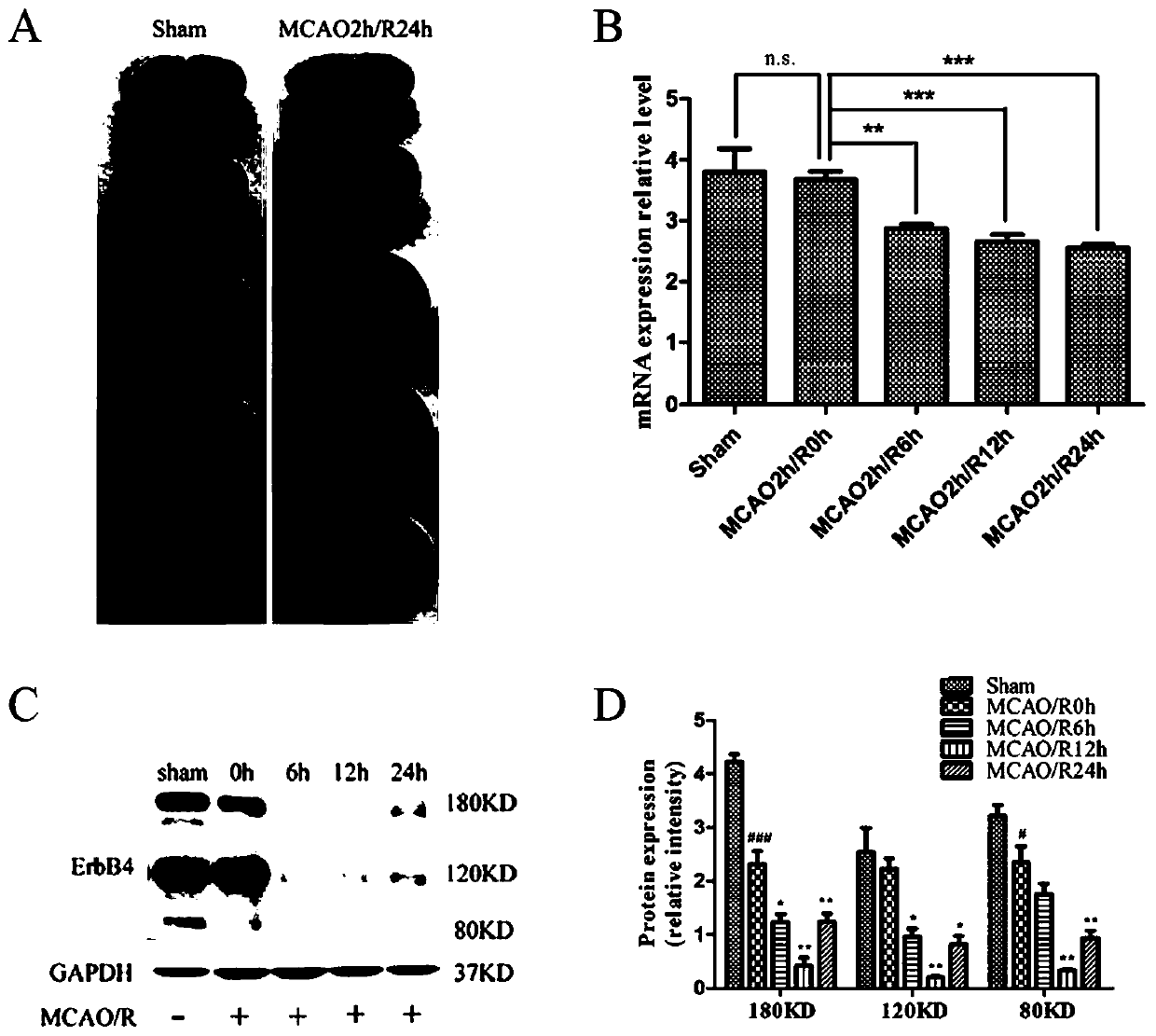 Application of membrane protein ErbB4 in preparation of medicines for treating cerebral ischemic injury