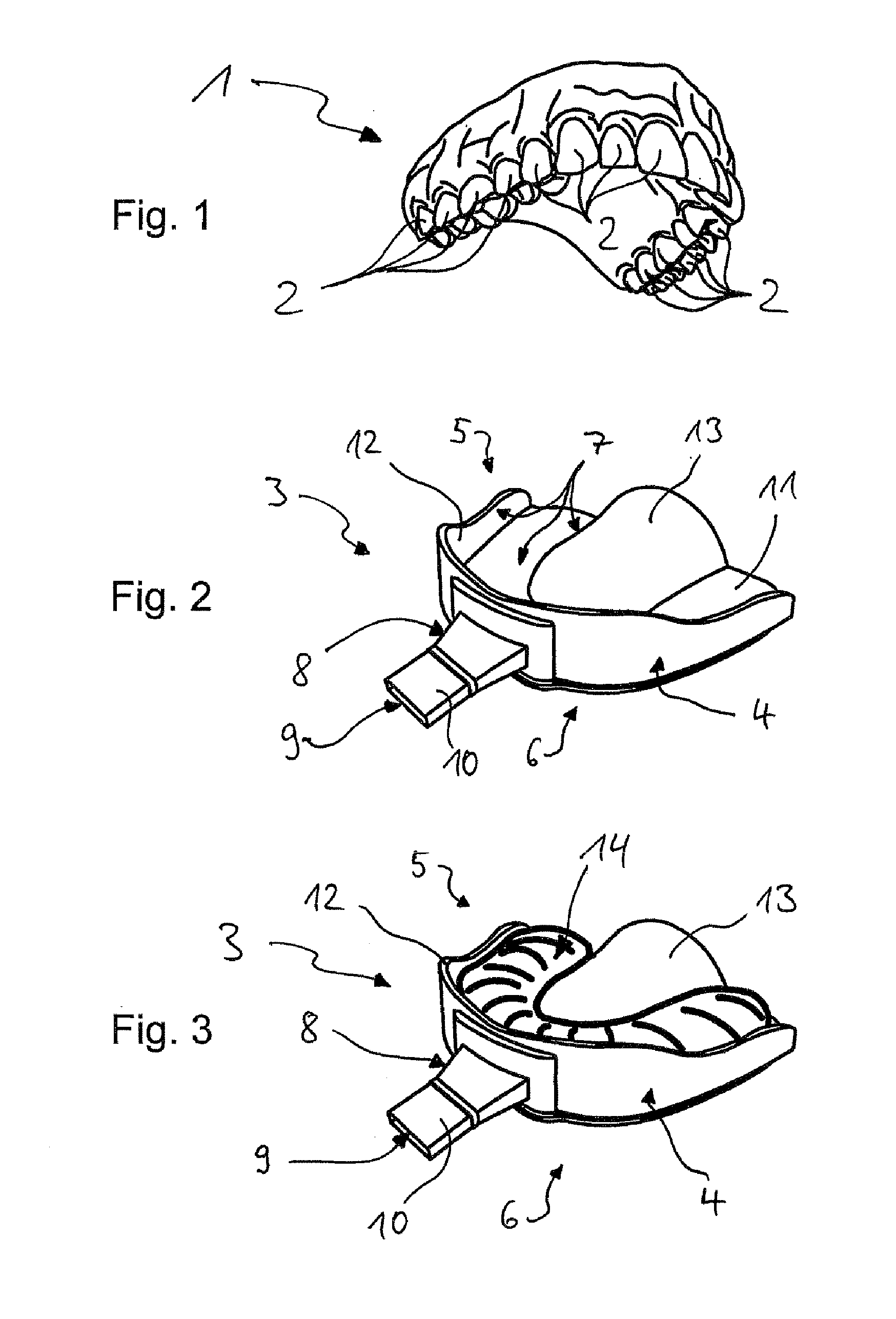 Impression tray, and method for capturing structures, arrangements or shapes, in particular in the mouth or human body