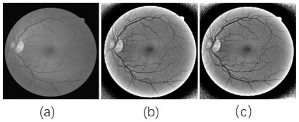 Retinal vessel segmentation method and device based on multi-scale matched filtering and particle swarm optimization