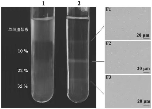 Dissociation and separation method for shellfish spermary spermatogenic cells