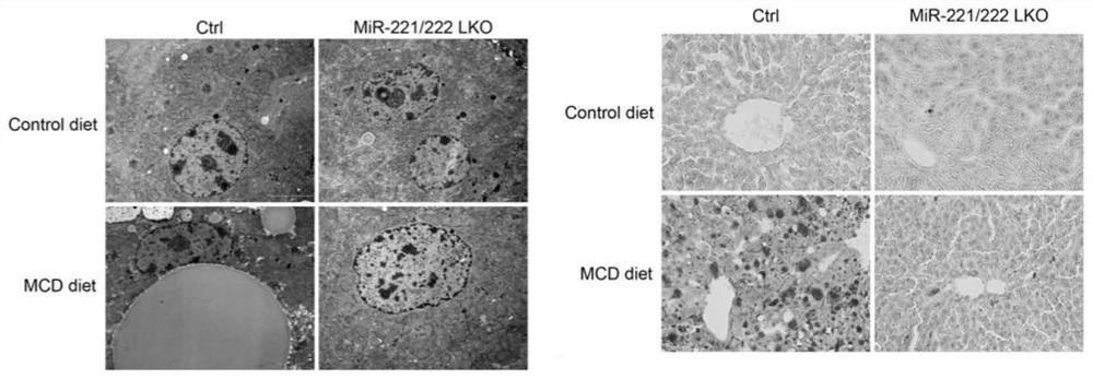 Application of miR-221 and inhibitor thereof to preparation of medicine for regulating and controlling liver fat deposition, liver fibrosis or hepatocellular carcinoma