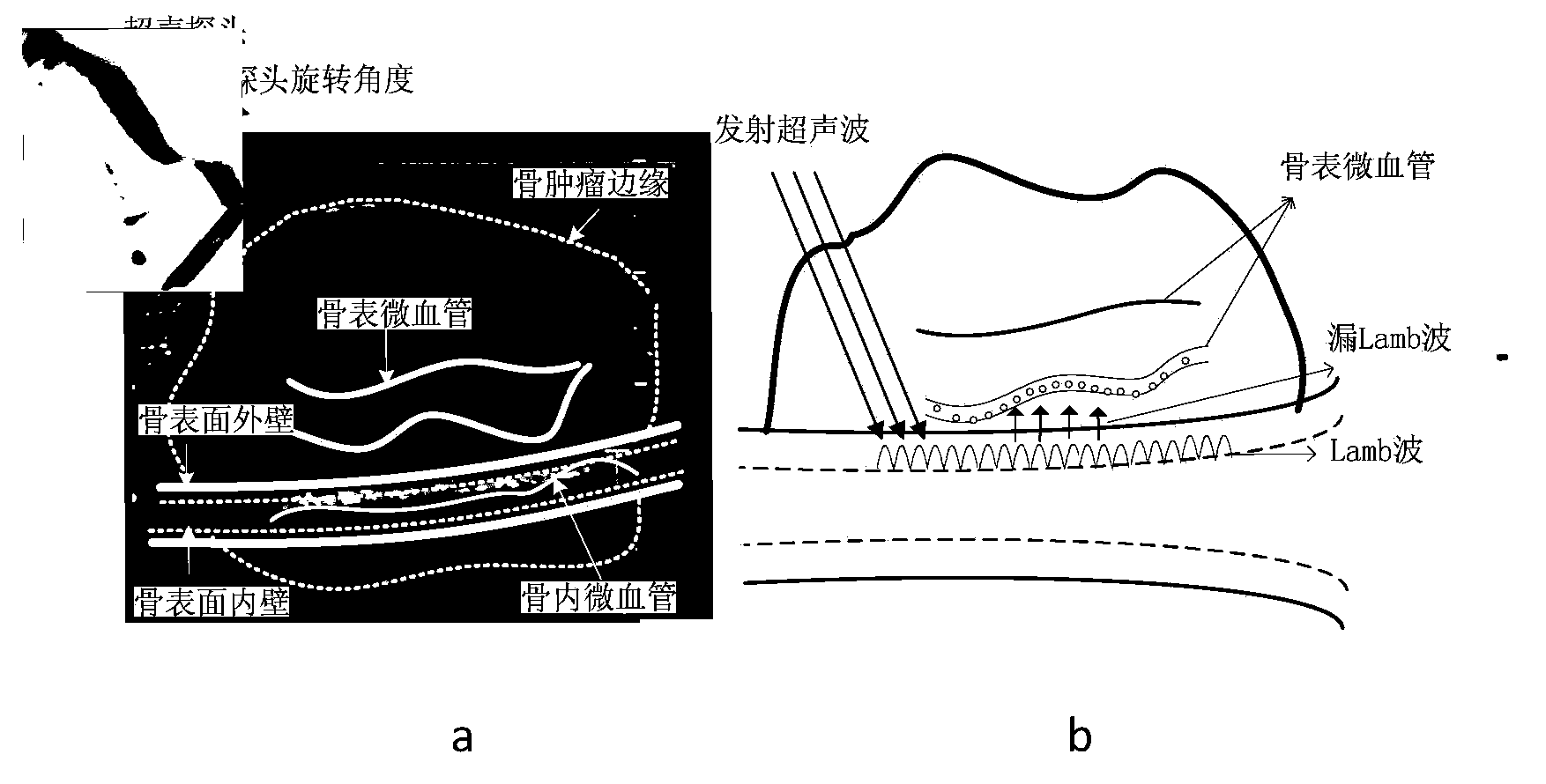 Blood perfusion separation detecting and imaging method for bone surface capillary