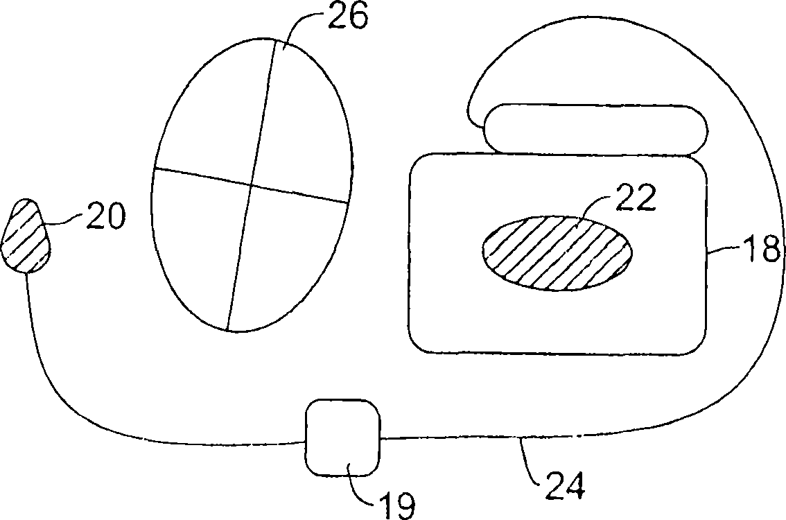 Multiple electrode vectors for implantable cardiac treatment devices