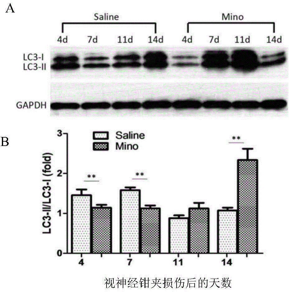 Application of minocycline in protection of retinal ganglion cells