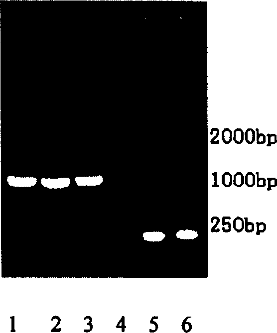 Human SP-A1 expression in pichia pastoris