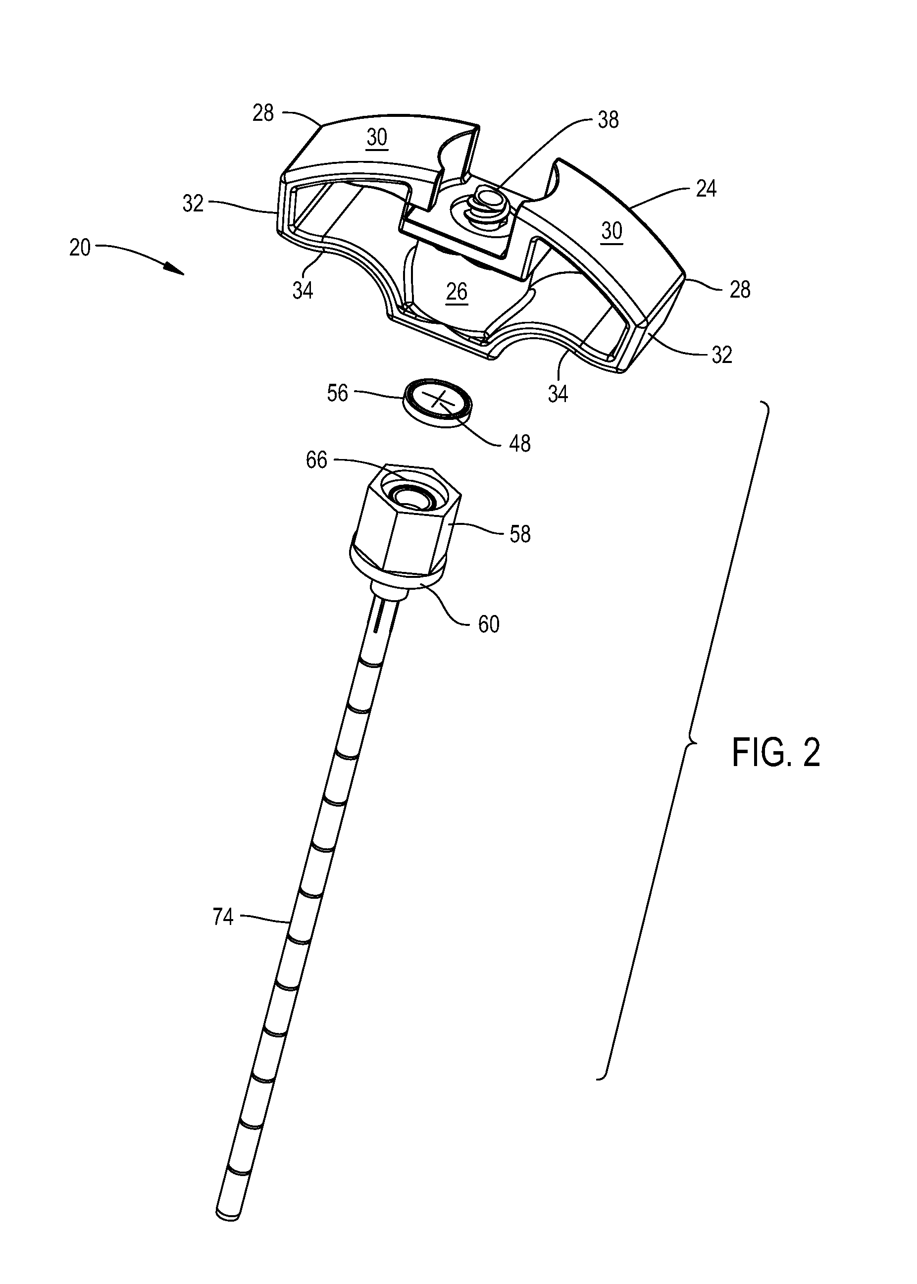 Bone cement delivery assembly with leakage prevention valve