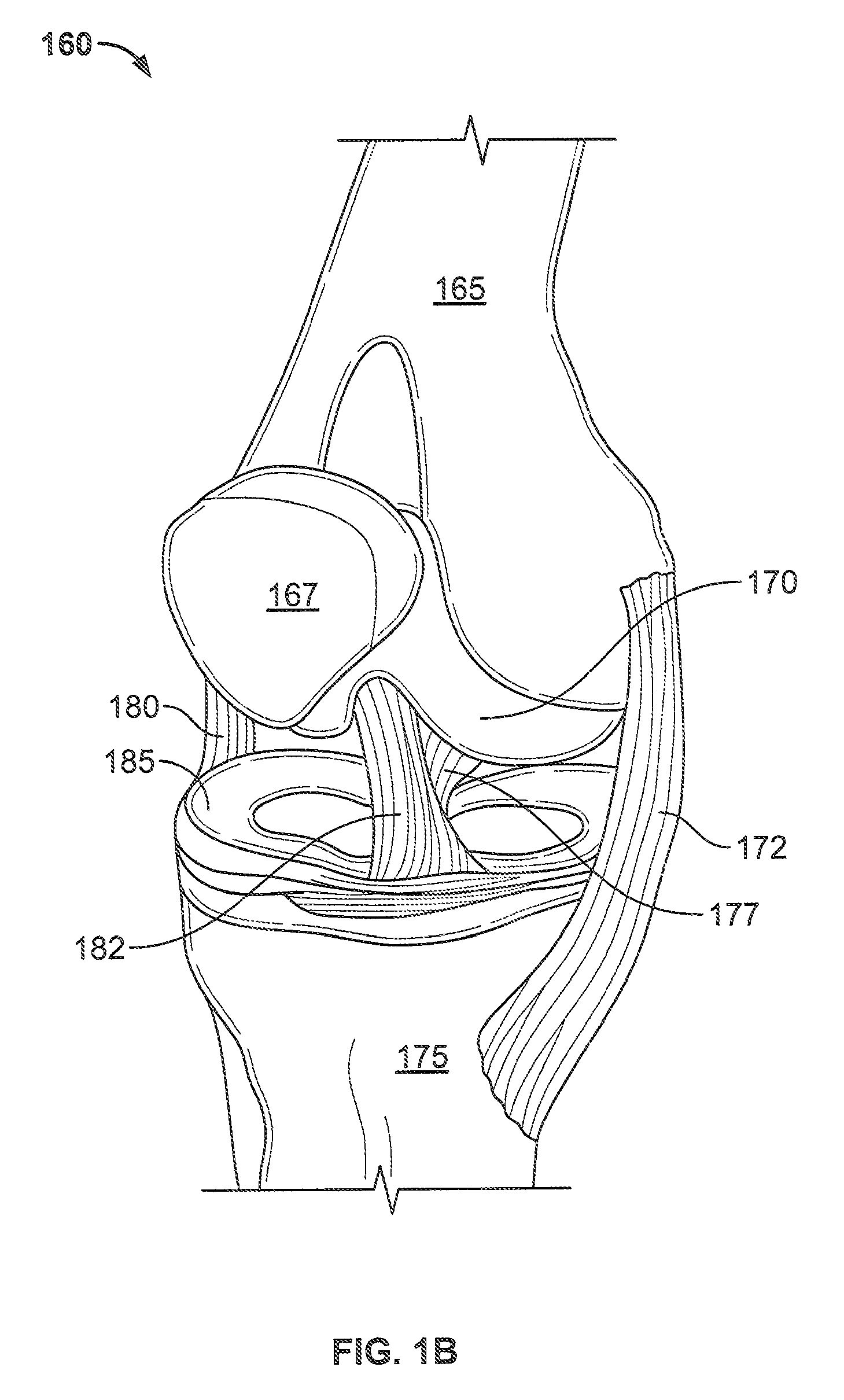 System and methods for treating or supporting human joints or a portion of the human body