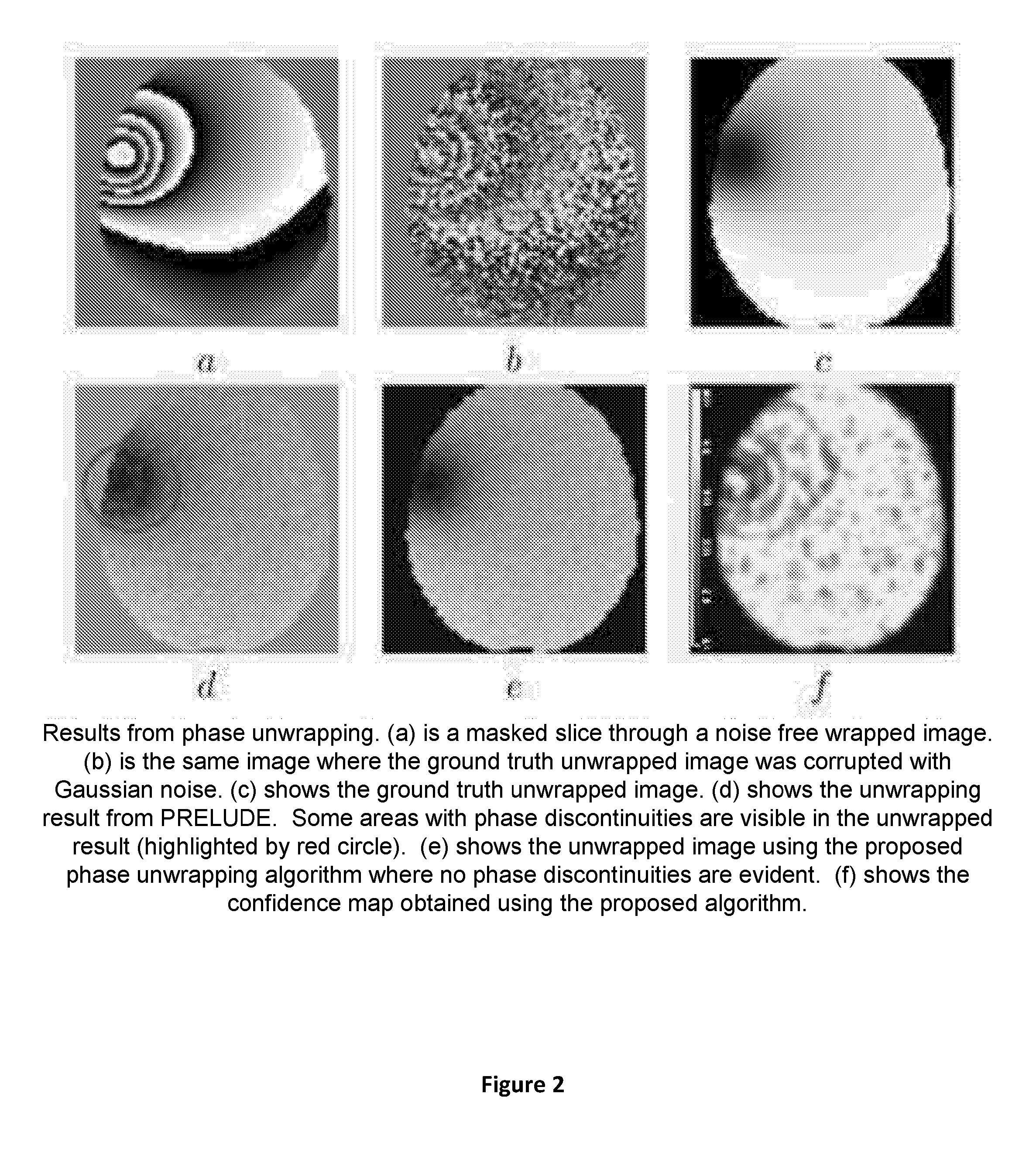 Apparatus and method for correcting susceptibility artefacts in a magnetic resonance image