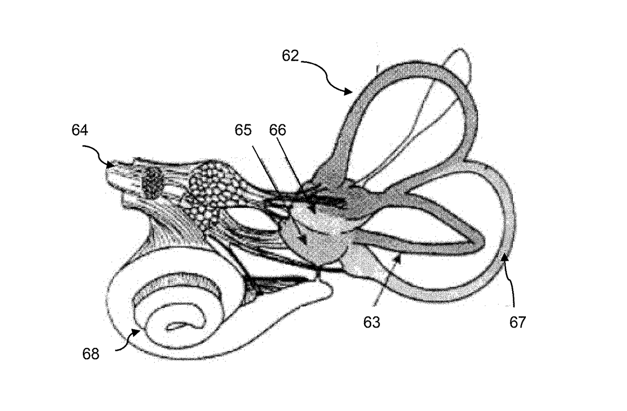 Methods for treatment of disease using galvanic vestibular stimulation