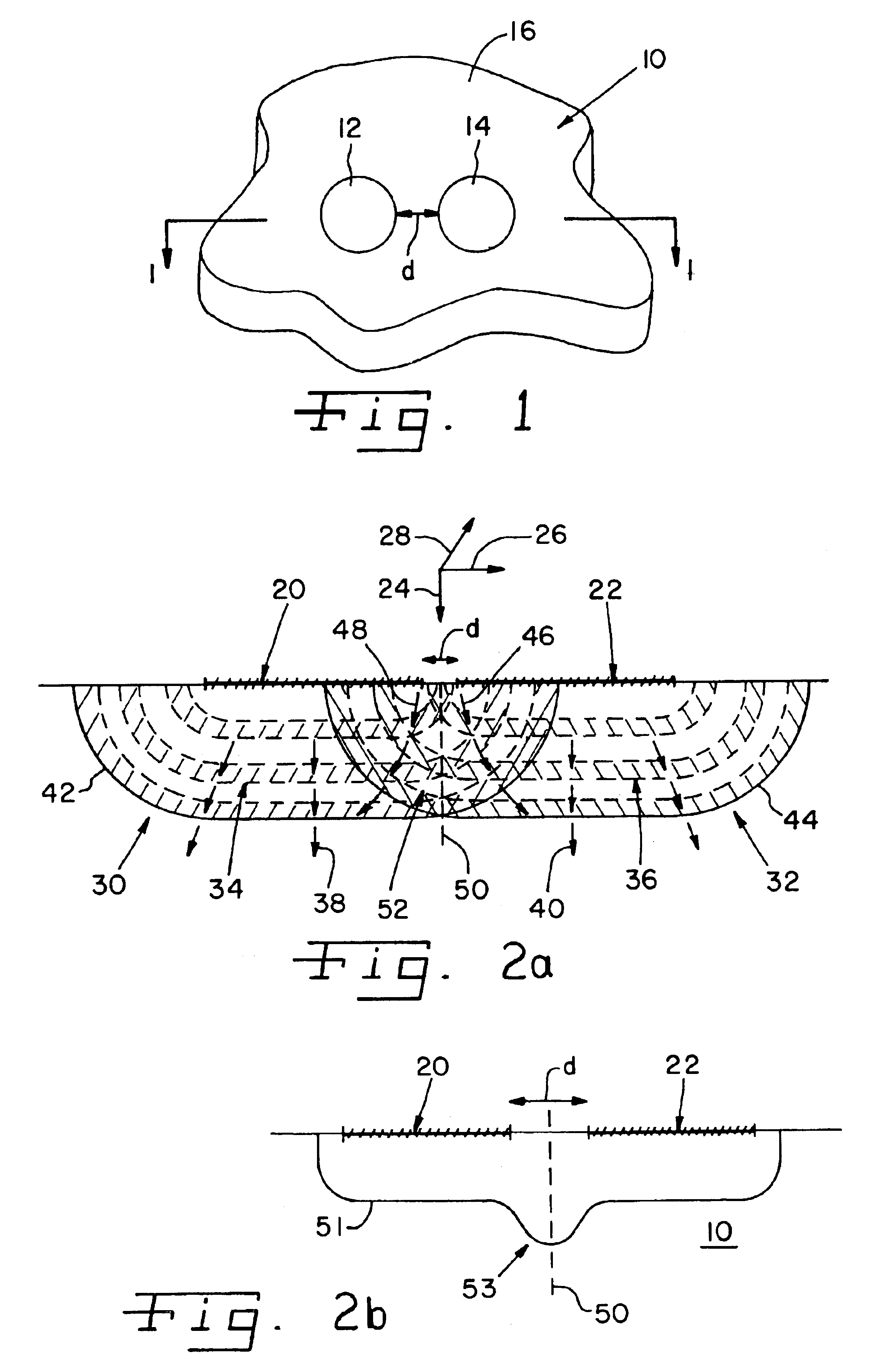 System for laser shock processing objects to produce enhanced stress distribution profiles