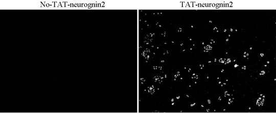 TAT (Trans-activating factor) kringle domain-modified nenurogenin2 fusion protein, as well as preparation method thereof and application thereof