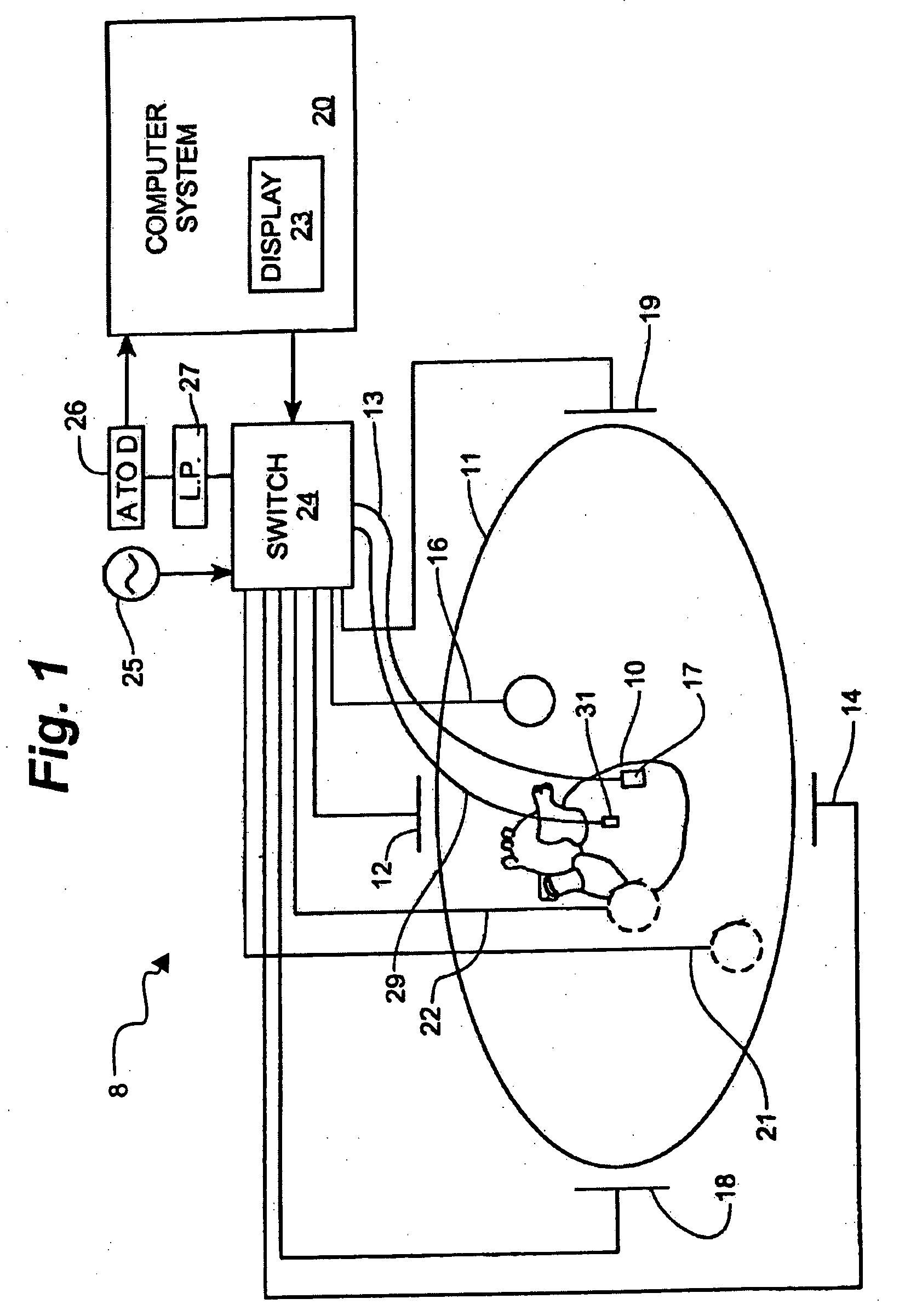System and method for local deformable registration of a catheter navigation system to image data or a model