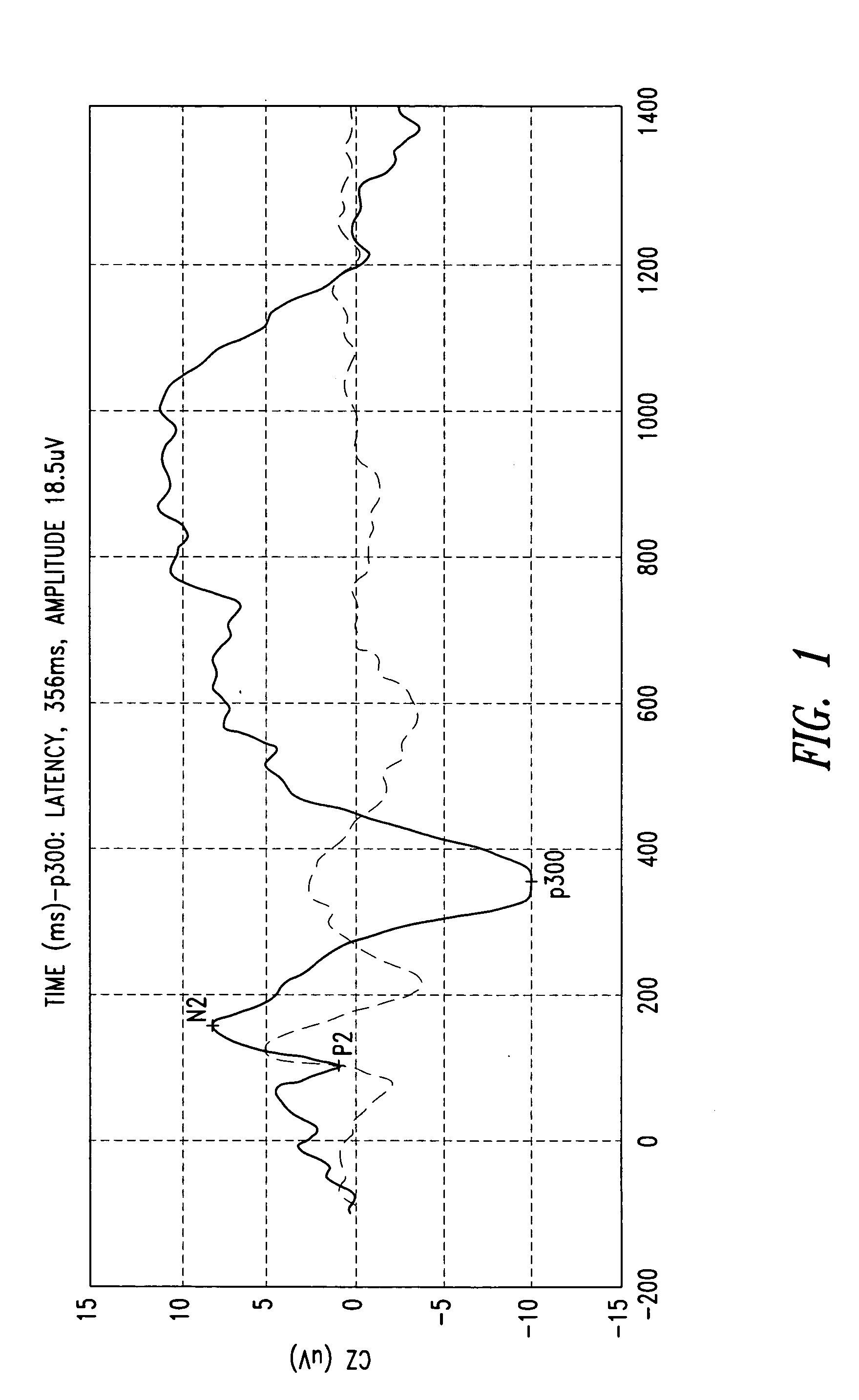 Man-machine interfaces system and method, for instance applications in the area of rehabilitation