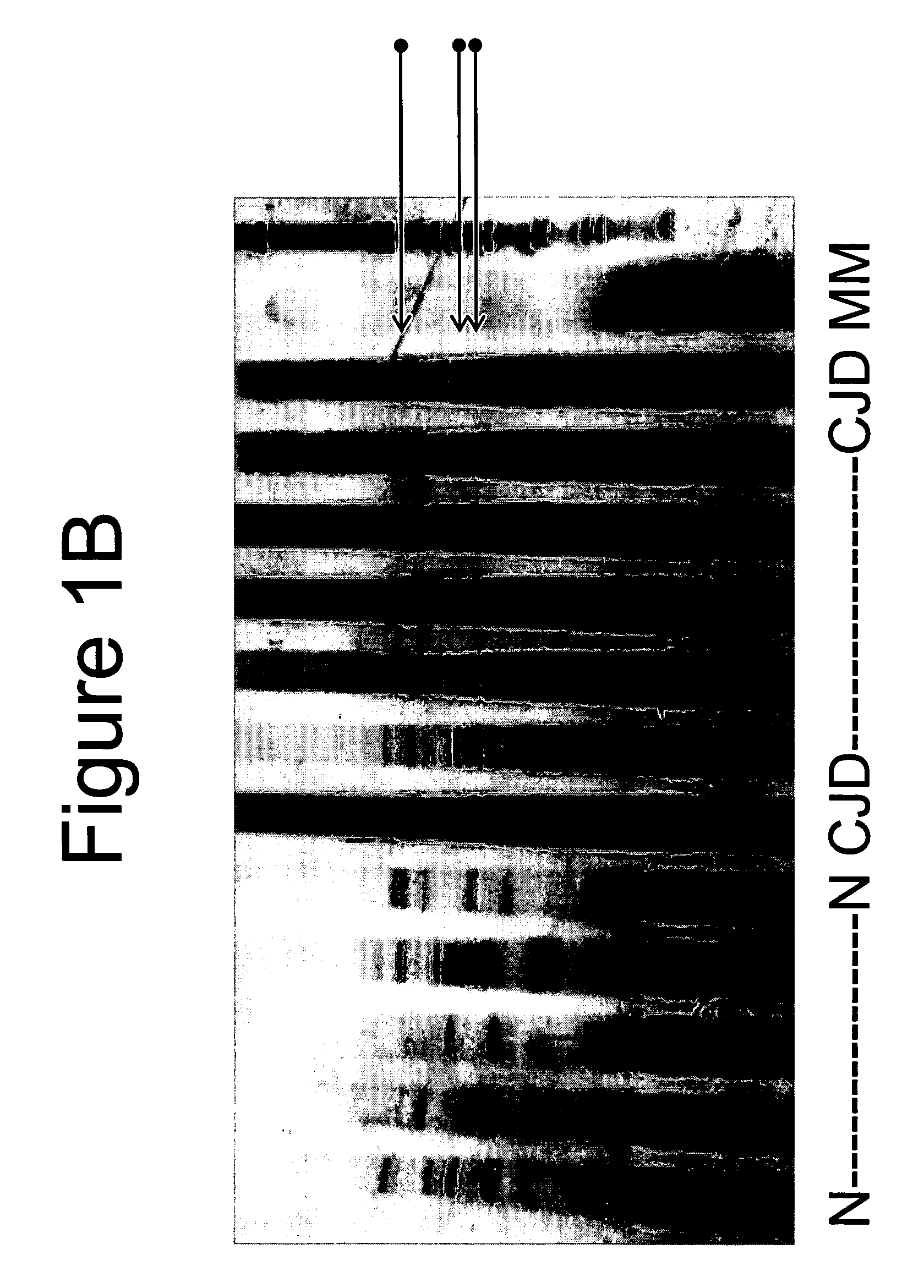 Detection of nucleic acids to assess risk for Creutzfeldt-Jakob disease