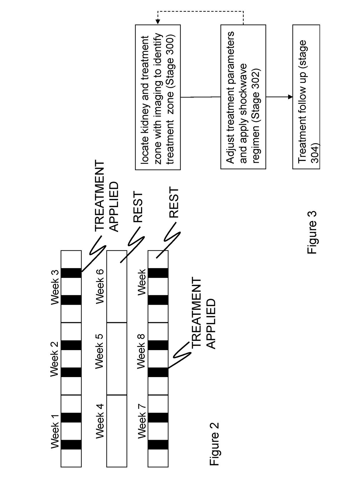 Method for imporoving kidney function with extracorporeal shockwaves