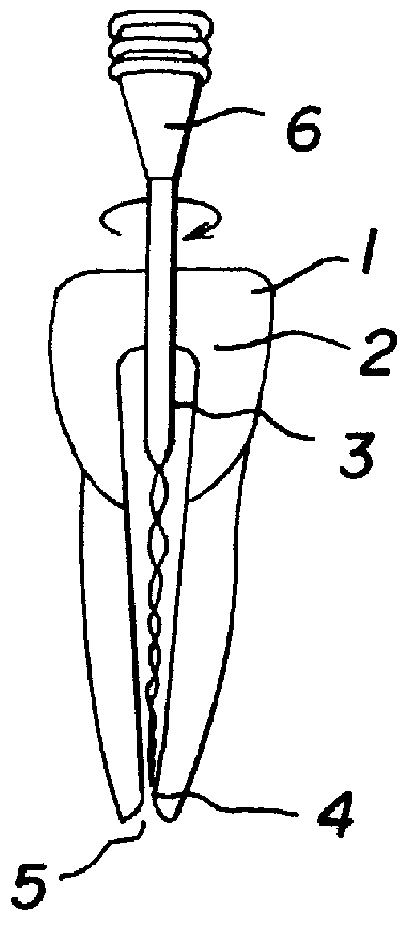 Root canal filling point