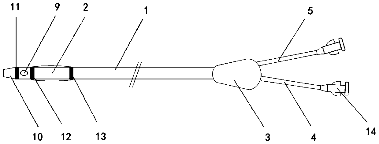 Double-cavity calculus removing balloon