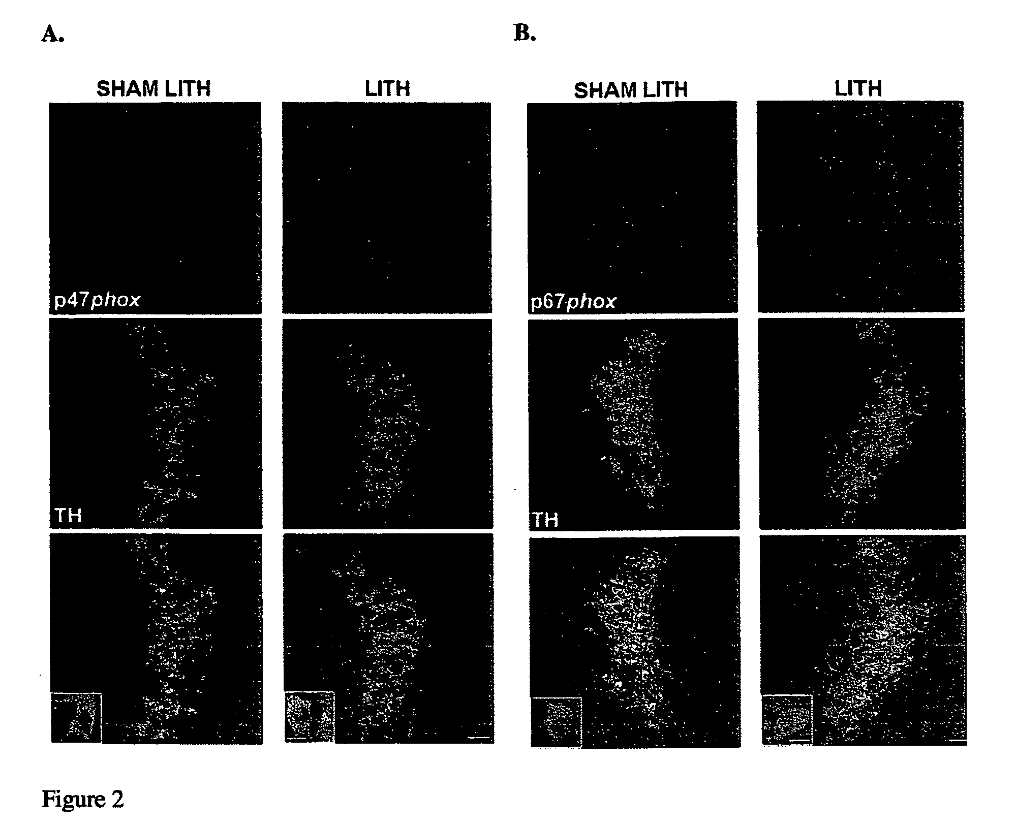 NADPH oxidase inhibition pharmacotherapies for Obstructive Sleep Apnea syndrome and its associated morbidities