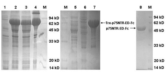 Preparation method of p75NTR-ED-Fc fusion protein and application of p75NTR-ED-Fc fusion protein in regeneration and functional recovery of injured central nerve