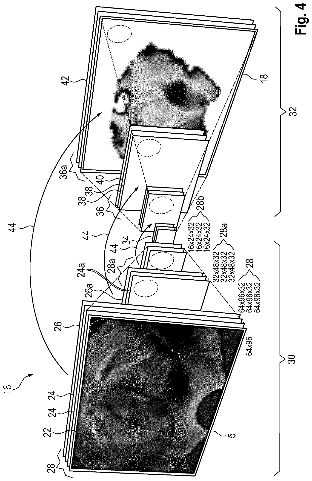 Method and system for generating a synthetic elastrography image